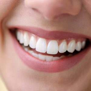 Diseño de Sonrisa con Resinas Estéticas