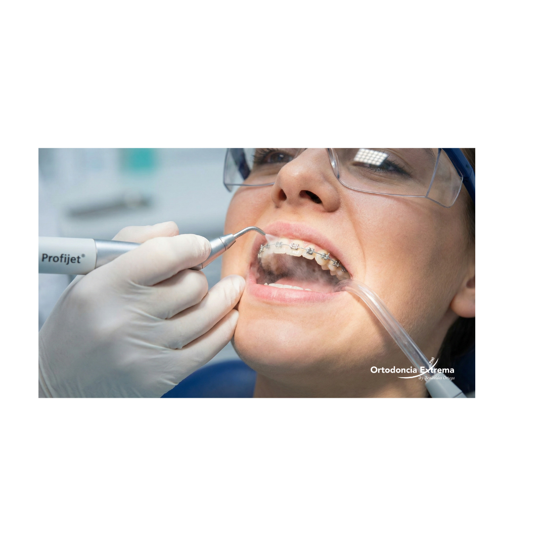 Profilaxis con Profijet - Image 2