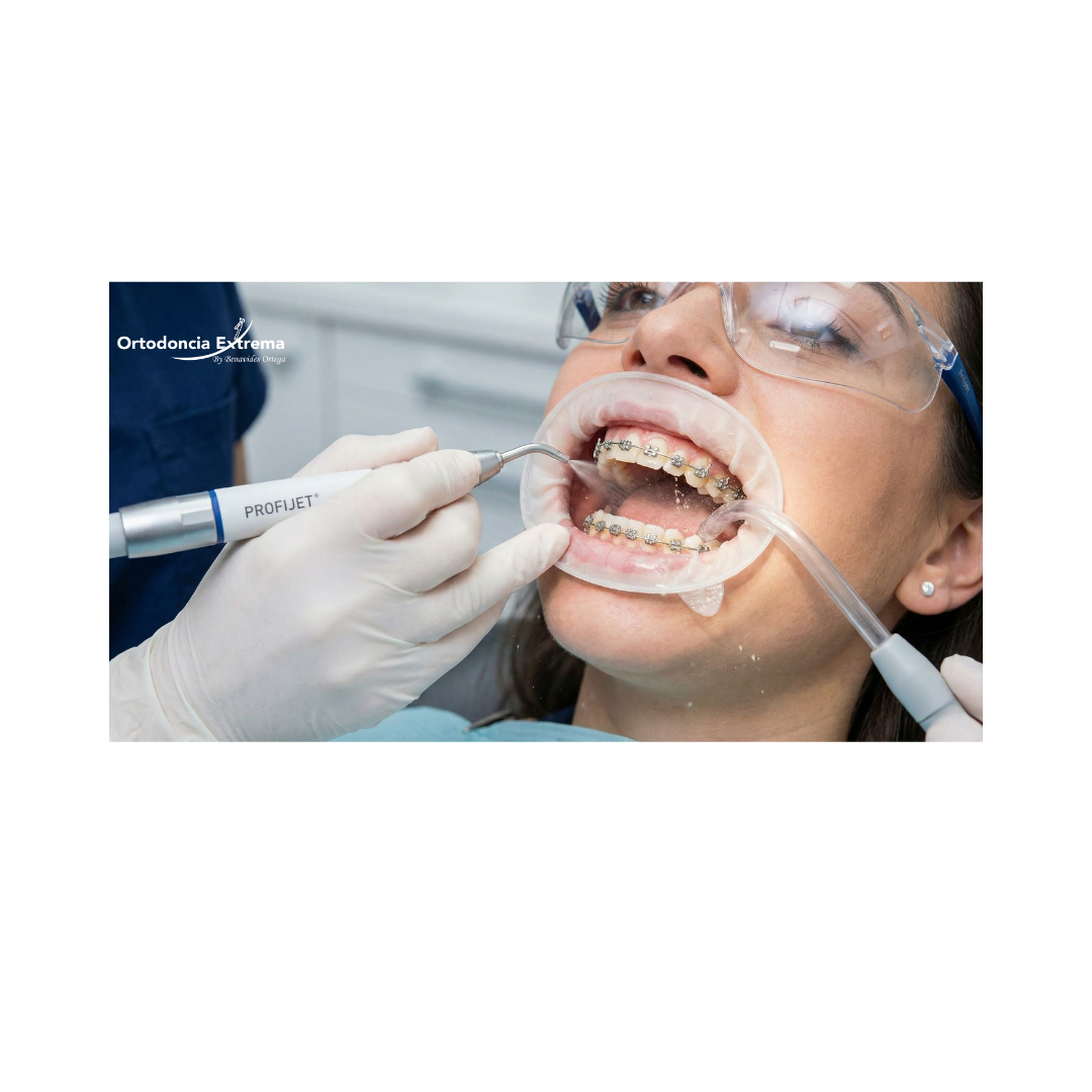 Profilaxis con Profijet - Image 3