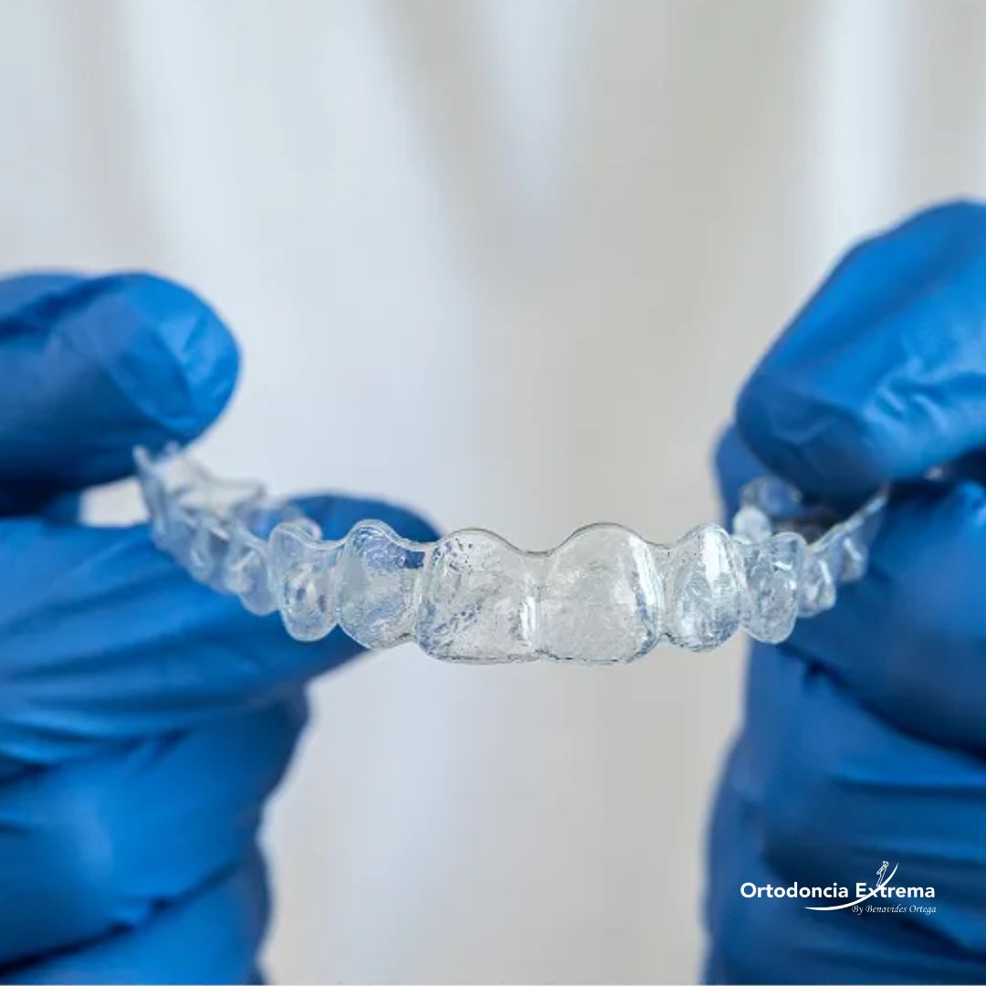 Tratamiento de Ortodoncia con Alineadores Nacionales - Image 3