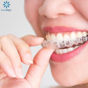 Tratamiento de Ortodoncia con Alineadores Invisaling