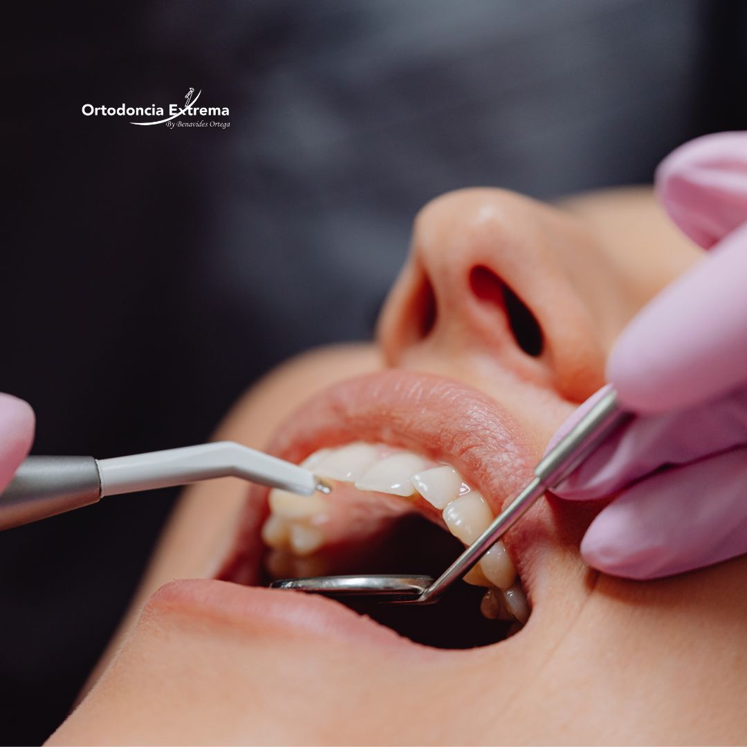 Profilaxis con Profijet